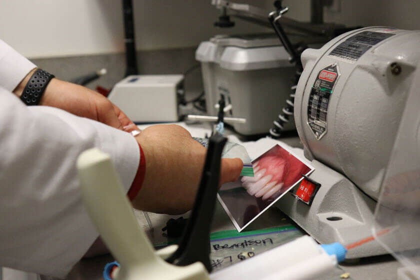 closeup of dental restorations being crafted at Allred Dental in San Marcos, CA