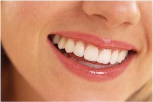 cosmetic dental services