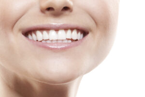 smile with porcelain veneers