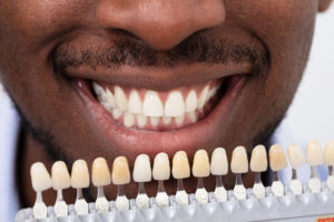 smiling with dental veneers