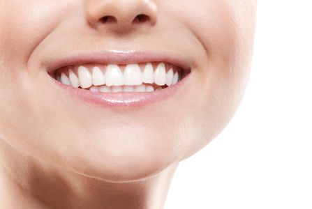 woman smiling with her new dental veneers
