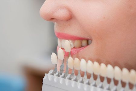 woman color matching her dental veneers