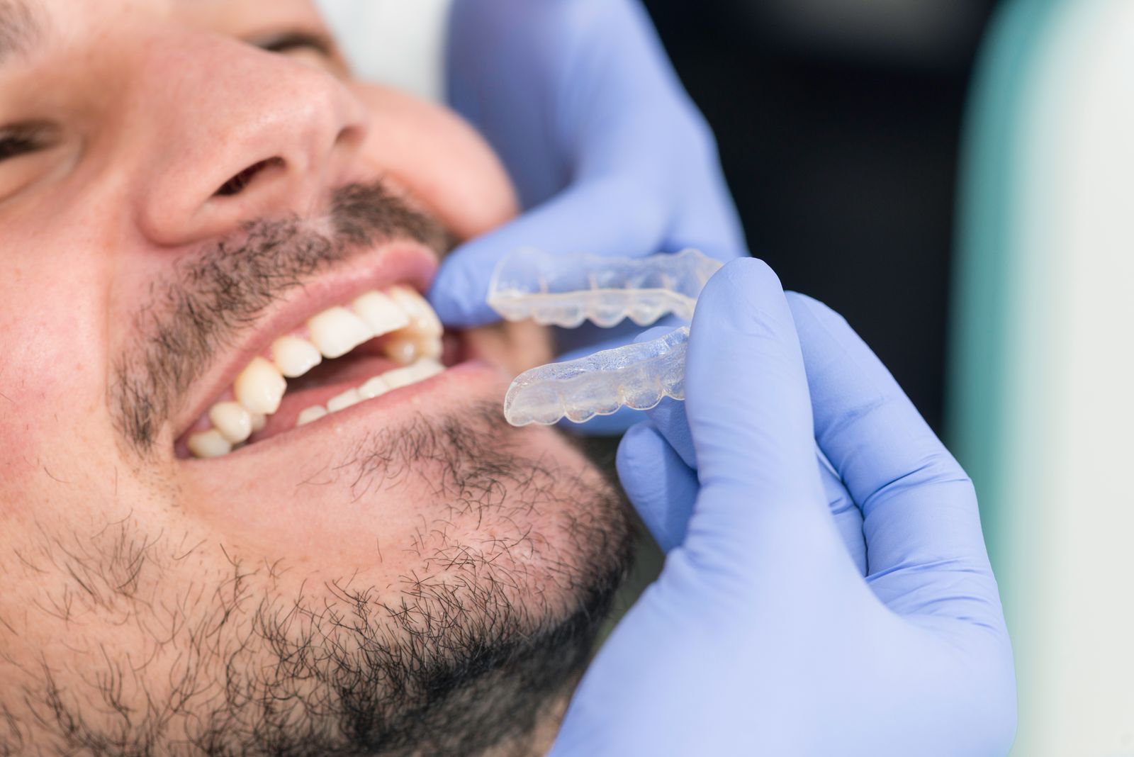 dentist inserting Invisalign into patient's mouth